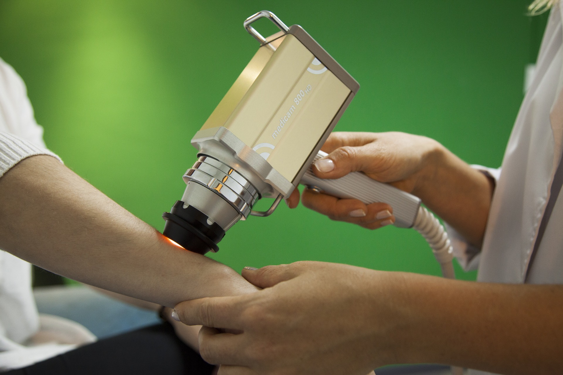 Usunięcie znamion ze skóry w Gdańsku